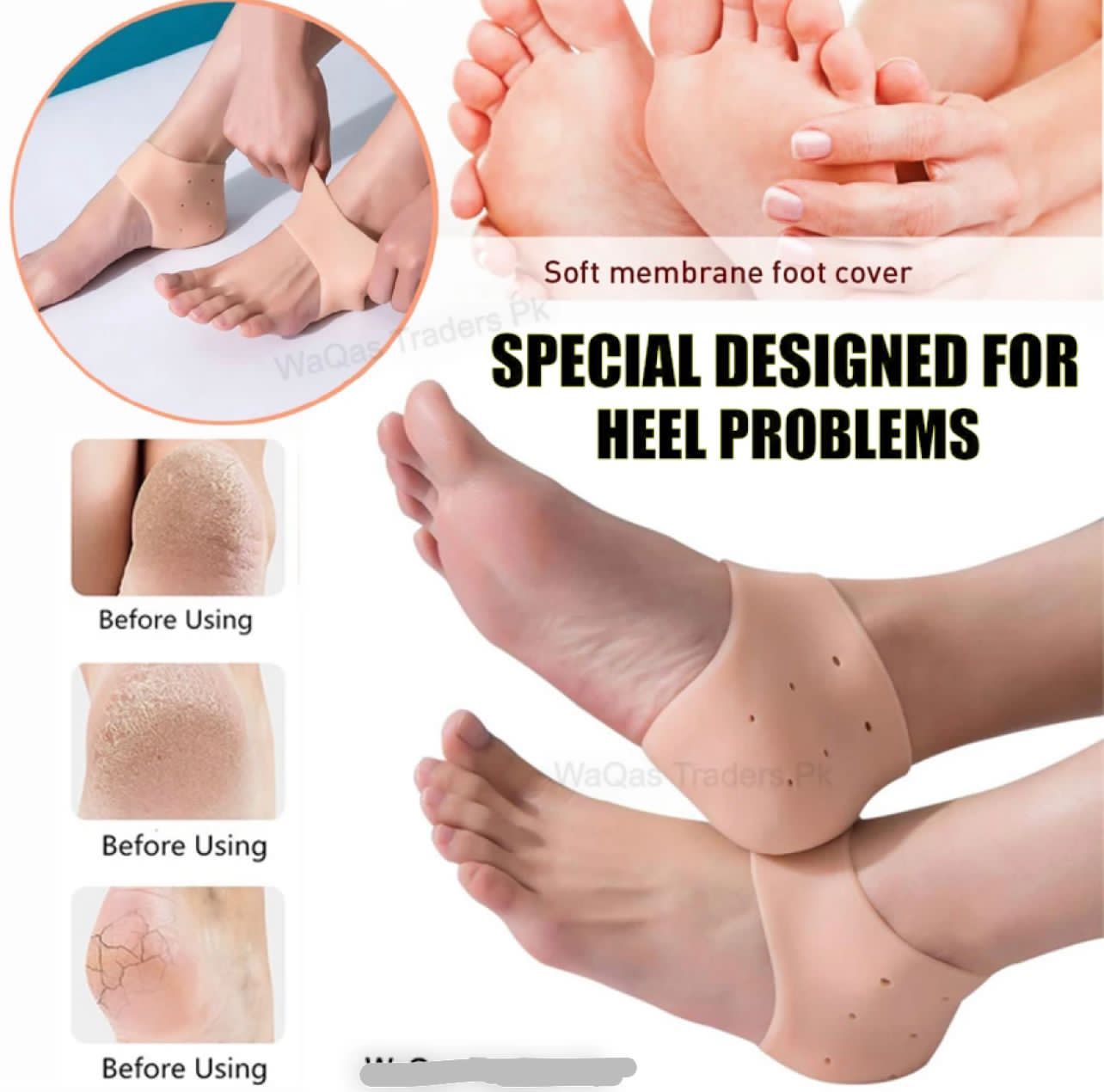 Pair of half Heel Pain Anti Crack Silicone Set - Anti Crack For Pain Relief Unisex With Box