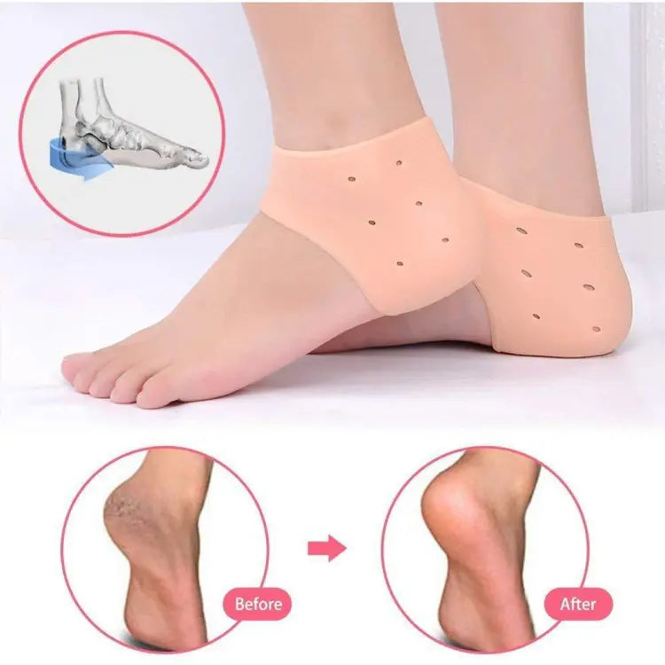 Pair of half Heel Pain Anti Crack Silicone Set - Anti Crack For Pain Relief Unisex With Box